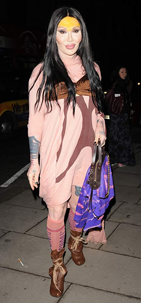 Pete Burns