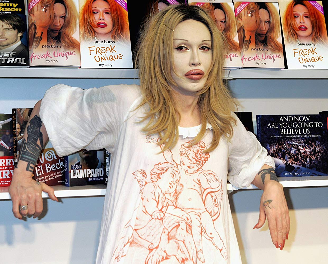 Pete Burns