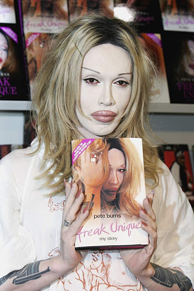 Pete Burns